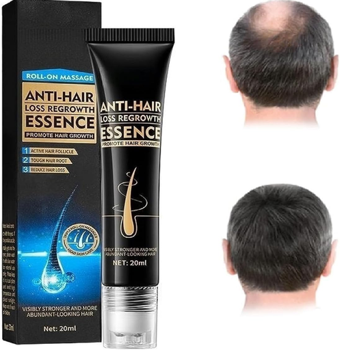 🌿 Capilux™ - Serum Roll On Crecimiento Capilar